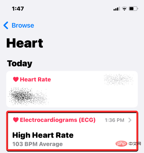 ecg-reading-on-iphone-3-b