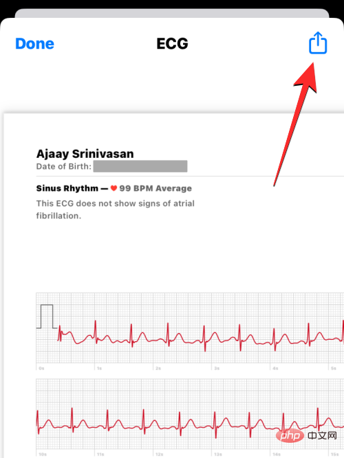 ecg-reading-on-iphone-14-a